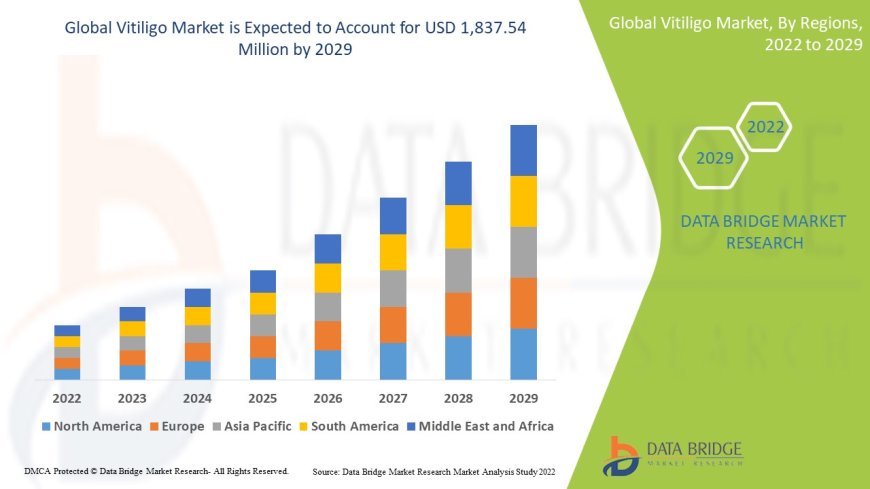 Vitiligo Market expected to reach USD 1,837.54 million by 2029