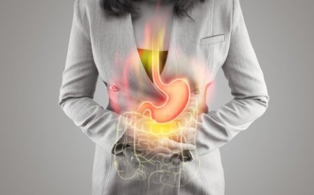 Top Causes of Acid Reflux and How to Manage Them Naturally